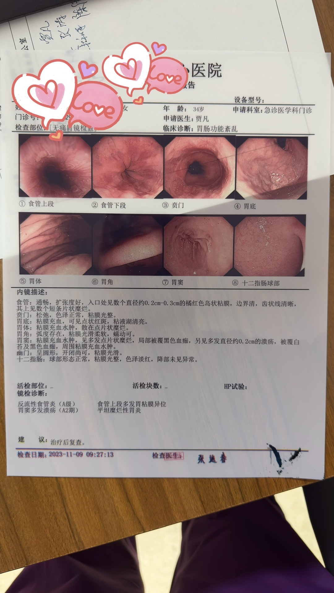 最新胃部检查技术，探索了解胃部健康的新途径