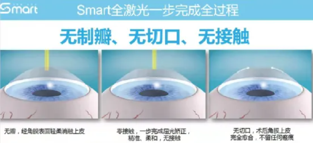 全飞秒激光技术最新进展及广泛应用概述